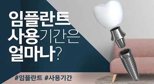 임플란트의 사용 기간은?